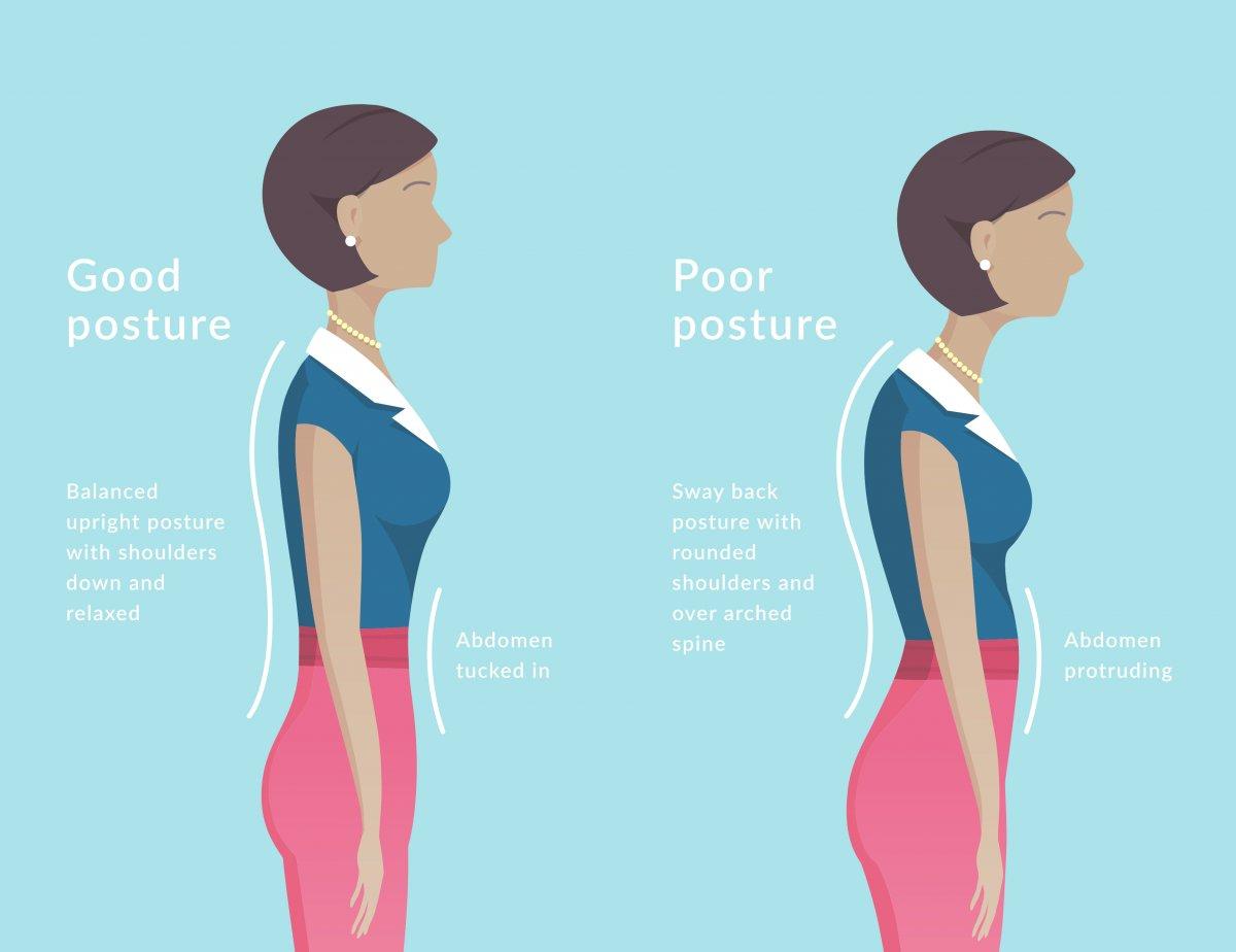 Why Standing Up Straight Won't Fix Your Posture